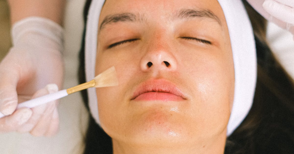 Avoiding Common Mistakes in Post-Chemical Peel Care