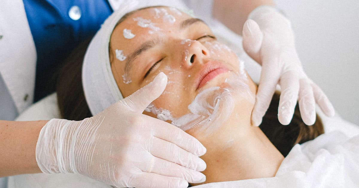 Chemical Peels for Acne Management: A Comprehensive Look