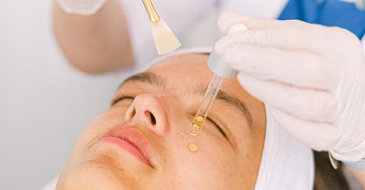 Insights into Blue Light Laser Treatments for Acne Management