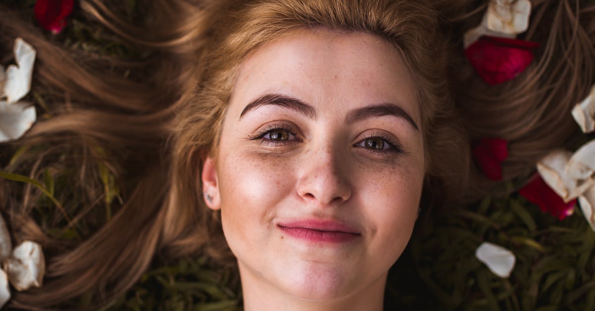 Post-Laser Treatment Risks Specific to Pigmentation Issues