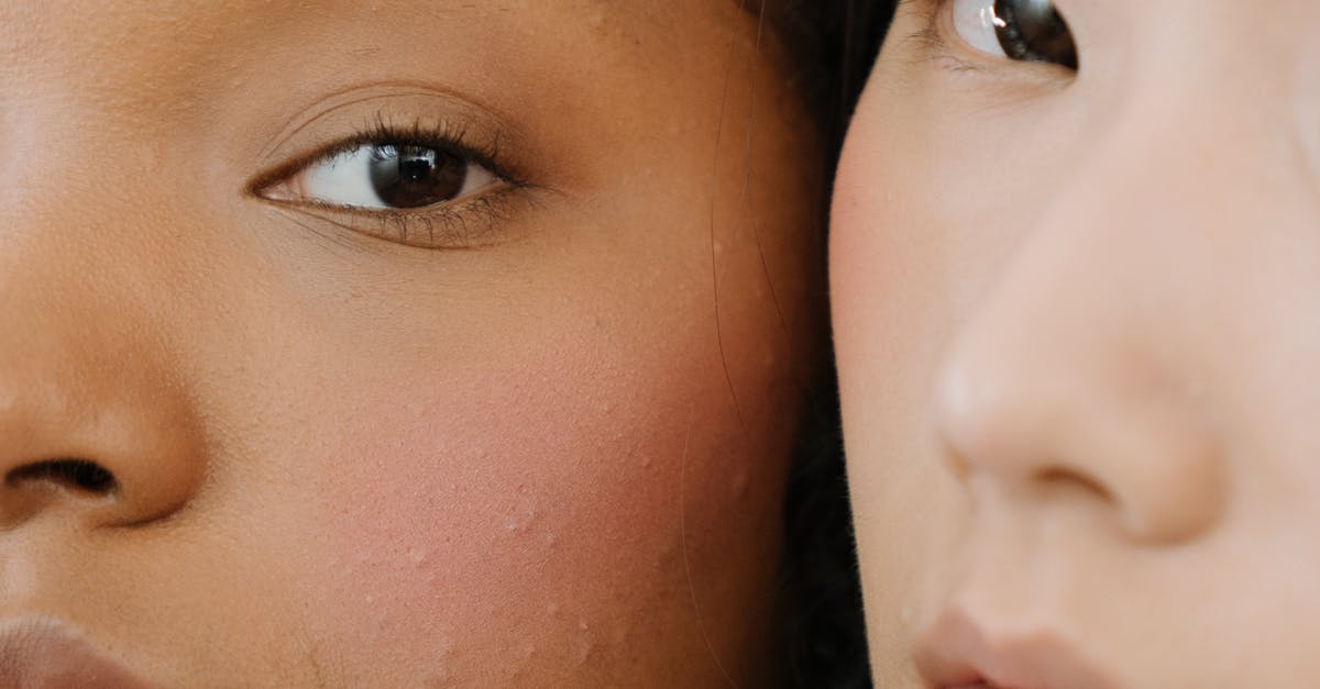 Short-Term and Long-Term Benefits of Microdermabrasion Explained