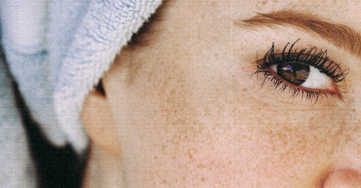 Understanding Common Risks Associated with Laser Treatments